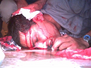 مجروح شده در حملات به قرارگاه اشرف.jpg