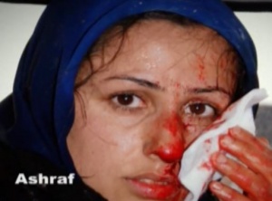 حمله شش و هفت مرداد به کمپ اشرف- یک زن مجاهد زخمی از سازمان مجاهدین خلق ایران